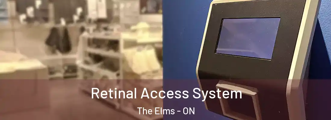  Retinal Access System The Elms - ON