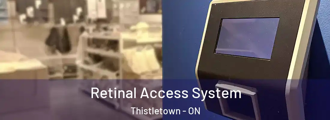  Retinal Access System Thistletown - ON